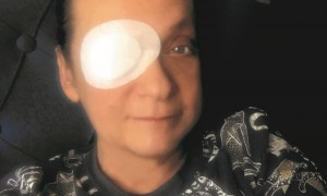 Žlutá čočka bez doplatku - Oční klinika Neovize